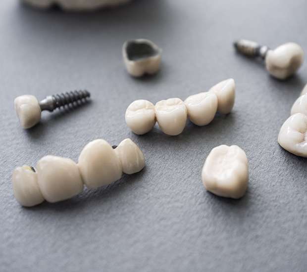 Los Angeles The Difference Between Dental Implants and Mini Dental Implants
